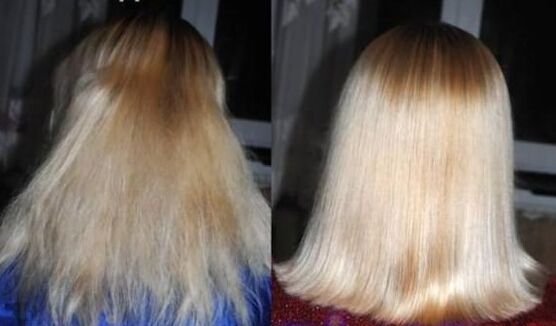 Before and after hair recovery